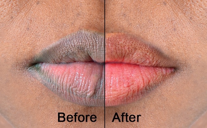 How To Get Pink Lips - battabox.com