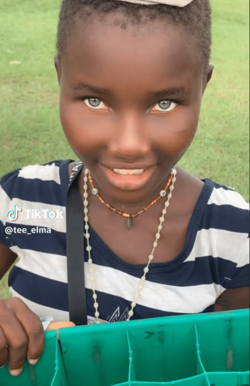 Little girl with unique eyes 
