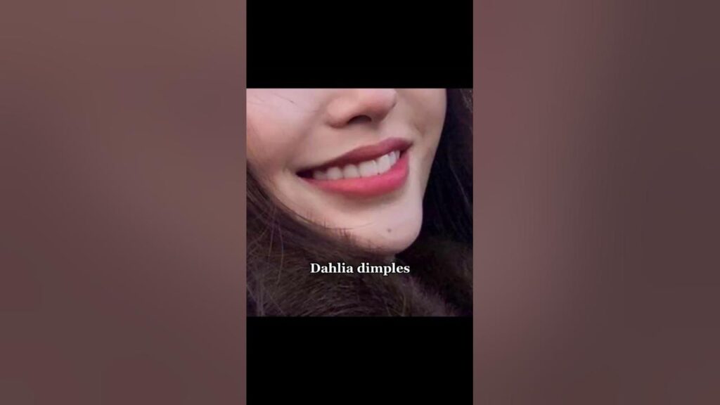 What are Dahlia dimples?