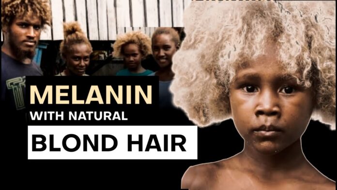 blonde african people of solomon islands