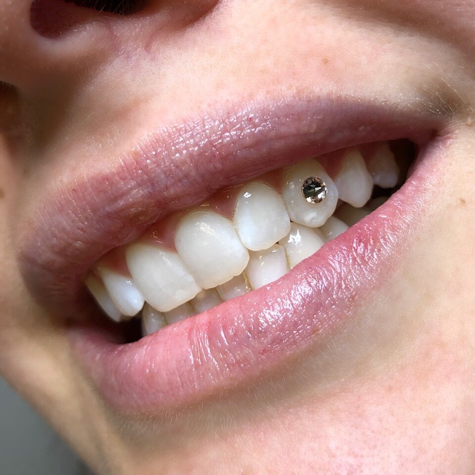 diamond tooth gems
