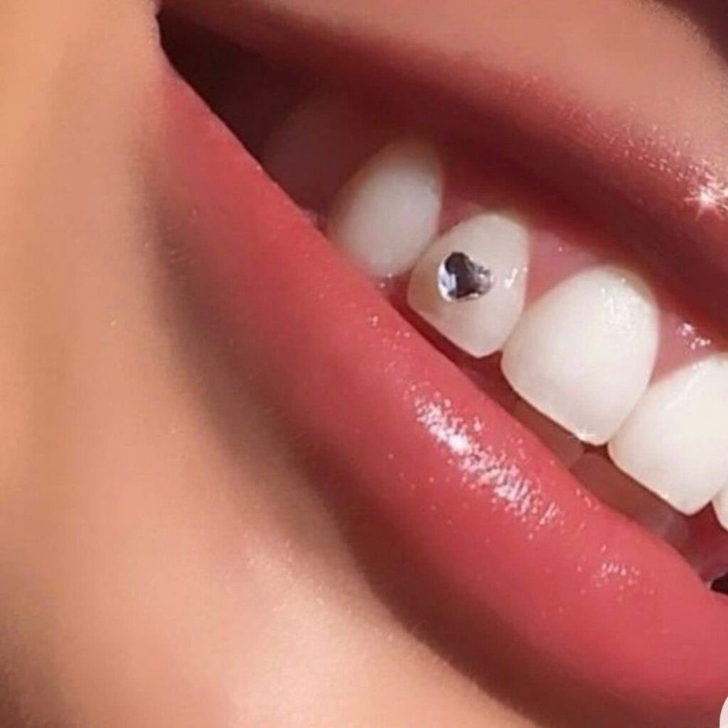 diamond tooth gems
