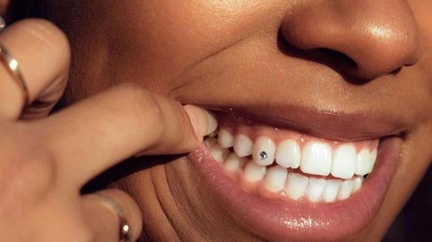 Are Tooth Gems Safe For Your Teeth?