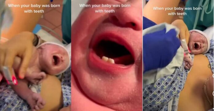 So shocking!: Woman gives birth to a baby with teeth | Battabox.com
