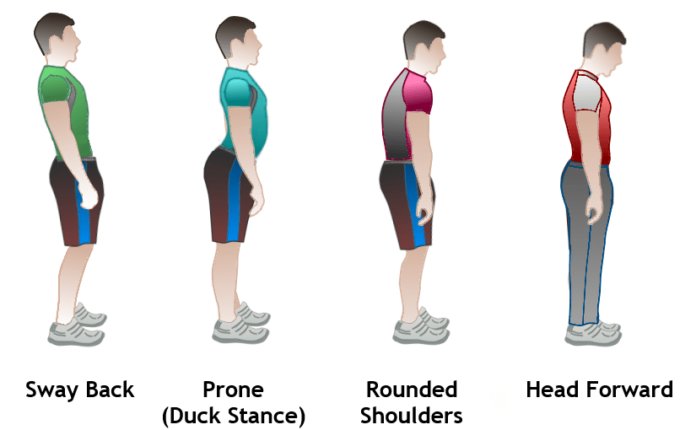 exercises to correct posture