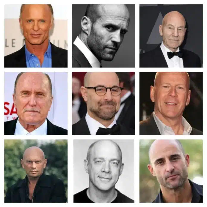 Famous bald actors