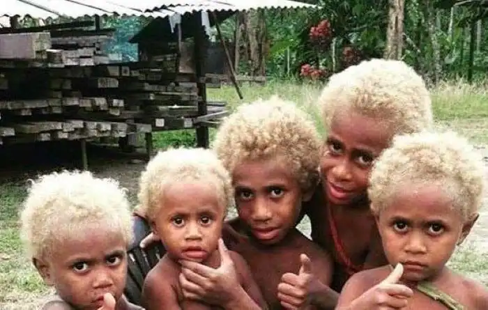 blonde african Kids of solomon islands