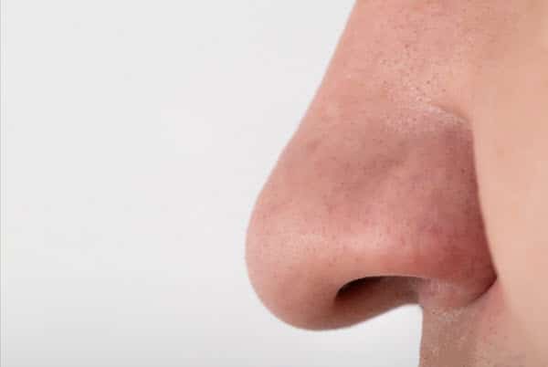 Types of Noses